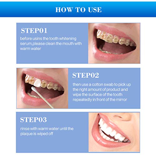 ? Едноставно? Практично чистење заби ги отстрани дамките за заби заби за белење на заби