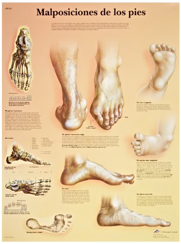3B Научен VR3185UU сјајна хартија Malposiciones de los Pies Анатомска табела, големина на постер 20 ширина x 26 Висина