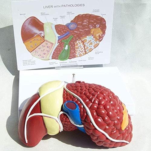 Model Model Model, Structure Science Anatomy Visceral Models 3D анатомски патолошки црниот дроб Анатомски модел за медицинска обука