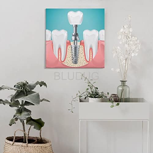 Постери за стоматолошки постер за стоматолошка болничка постер за стоматолошка плака за сликарство, сликарско уметничко постер