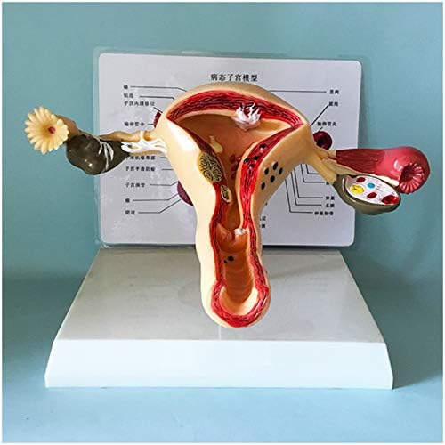 KH66ZKY патолошки модел на матка - Модел на матка и јајници - женски репродуктивен систем човечко тело Анатомија реплика за алатка за едукација