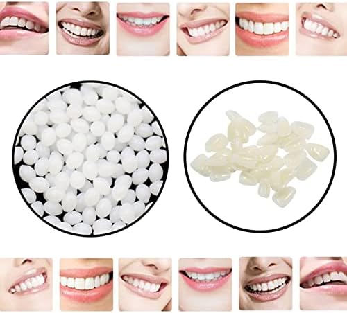 Комплет за привремена поправка на забите OTCPP, фурнири за заби за да ја поправат наставата за заби што недостасуваат