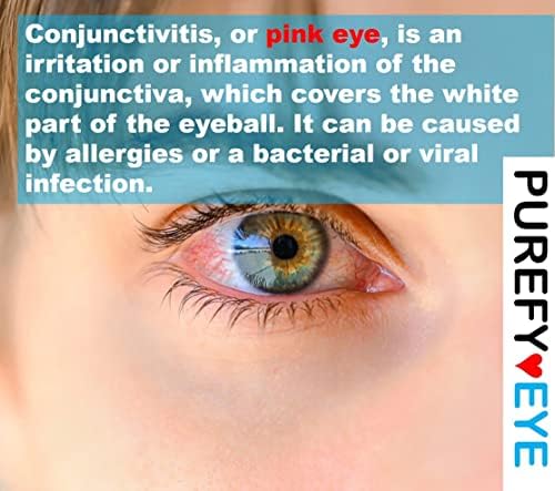 Чистокрвен Розов Спреј За Очи. Хипохлорен Очен Капак Секојдневно Чистење За Ослободување од Розови Очи, Иритации или Воспалени Состојби